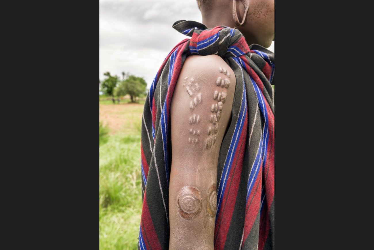 Body scarification – West Africa.jpg