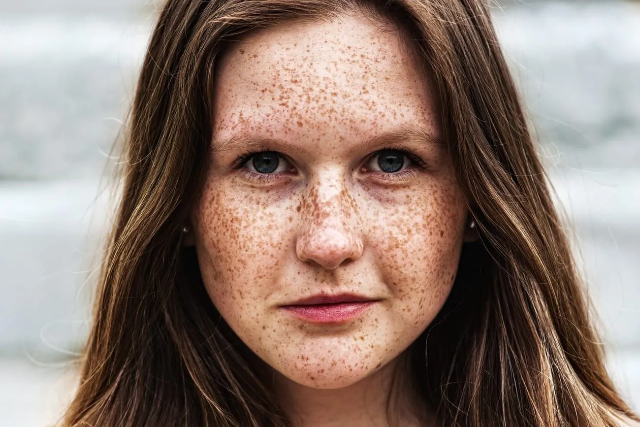 Freckles – Ireland.jpg?format=webp