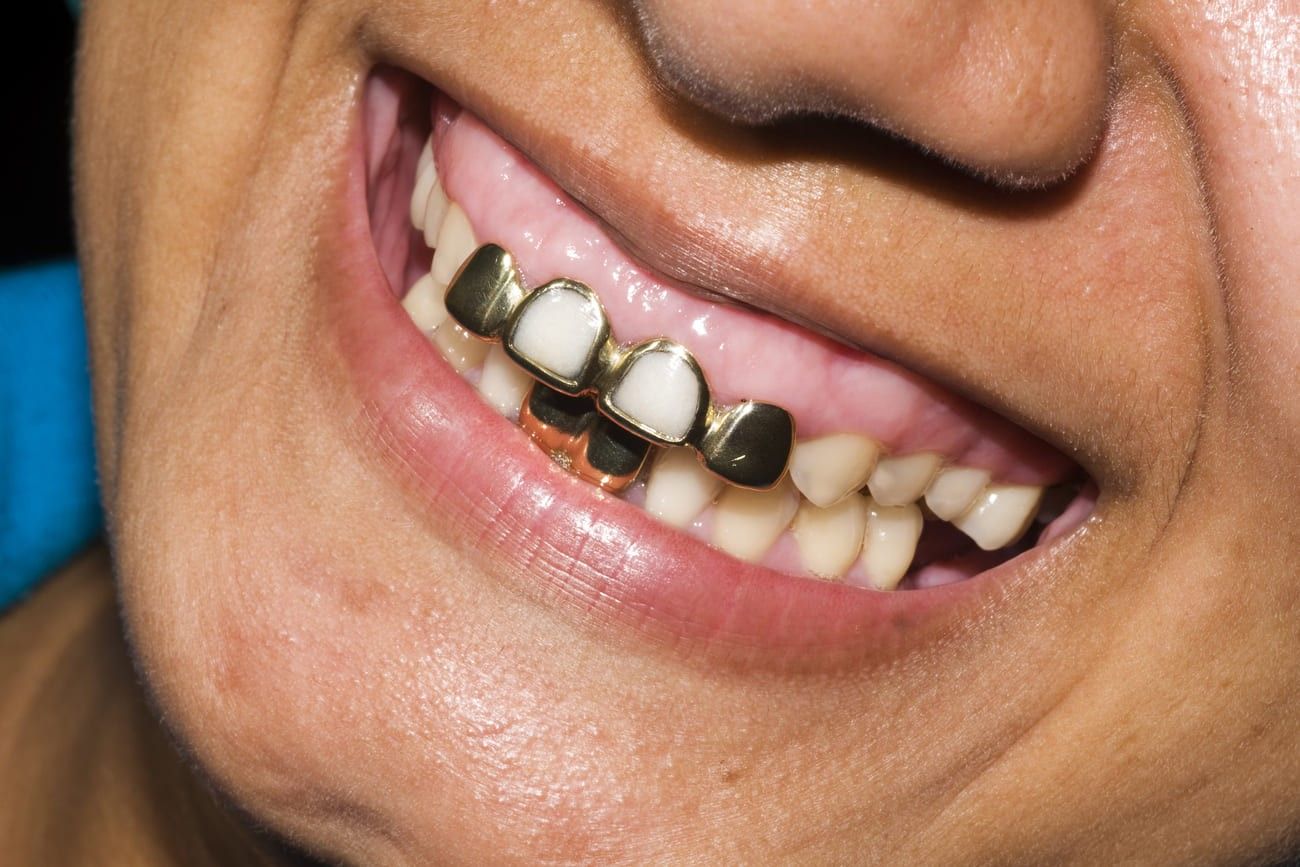 Gold teeth – Tibet.jpg