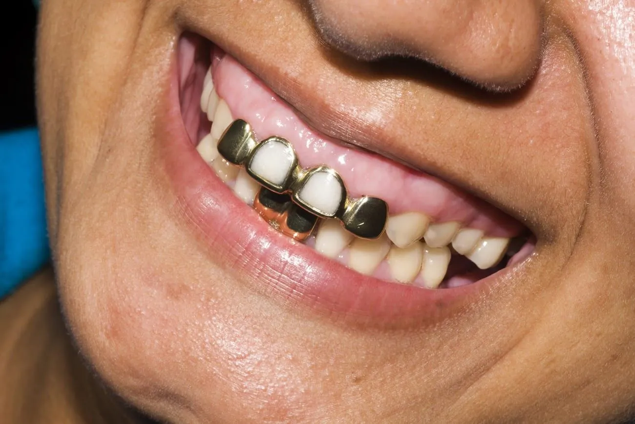 Gold teeth – Tibet.jpg?format=webp
