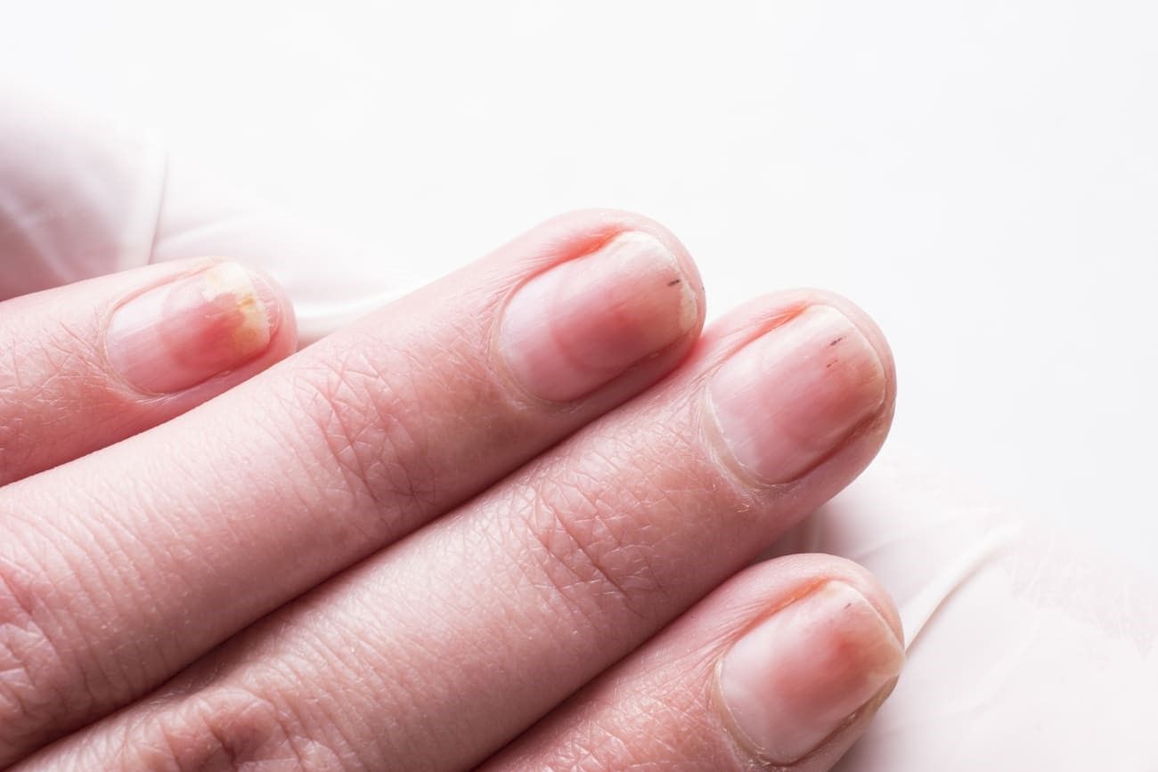 Nails without manicure – Spain.jpg